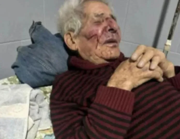 Jubilado de 84 años sufre brutal asalto en Las Termas de Río Hondo