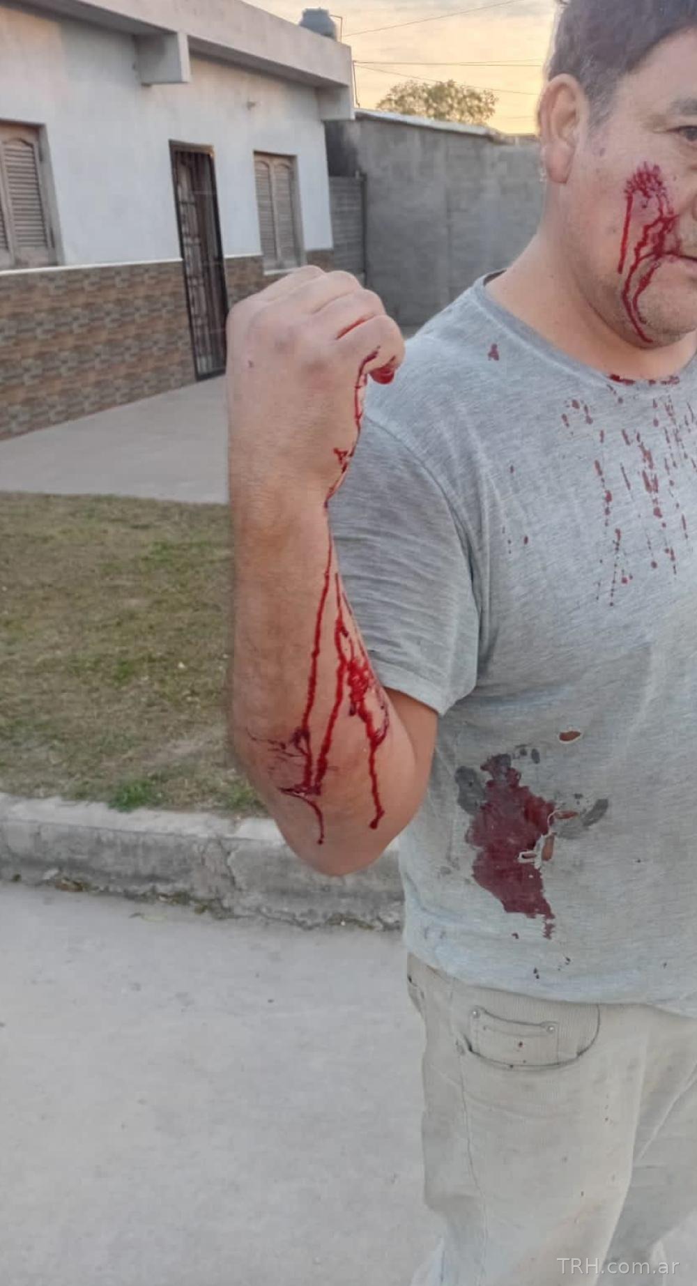 Intervención policial y médica tras un ataque de perros en el barrio Borges
